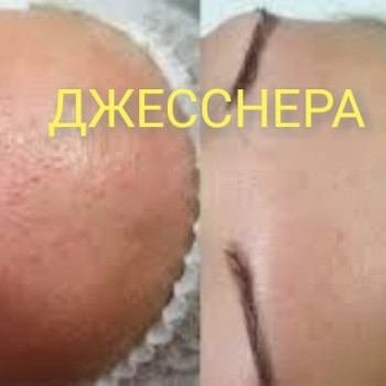 Хімічні пілінги
                    Массажист Юлія Киев