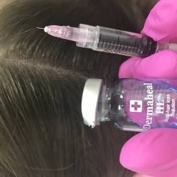 Лечебный коктейль для эффективного восстановления роста воло