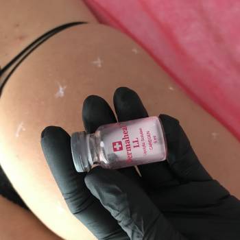 Dermaheal LL - уникальный по составу липолитический коктейль