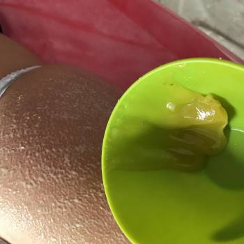 Медовый массаж — древний метод ухода за телом. Он отлично пи