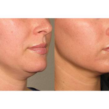 Ирина Ситникова, Киев Фото - 27