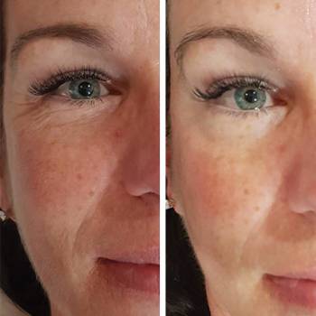 Ирина Ситникова, Киев Фото - 29