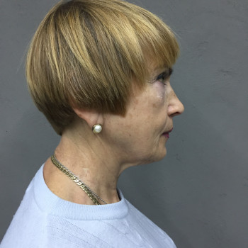 Тетяна Нетреба, Київ Фото - 21