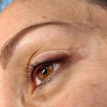 Perfect Vision, Ивано-Франковск Фото - 9