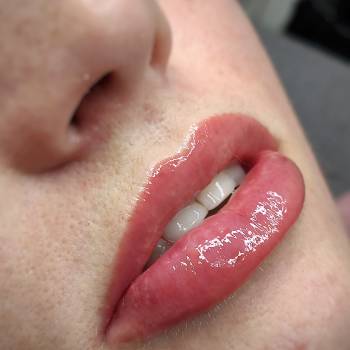 Perfect Vision, Ивано-Франковск Фото - 10