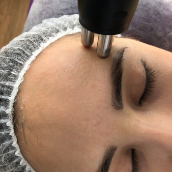 Радиоволновая подтяжка кожи (RF-лифтинг)
                    Косметологический центр Nina Beauty Studio Херсон