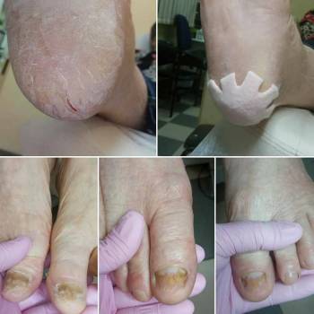 Фото с портфолио Центр подології Наталі Базилевскої