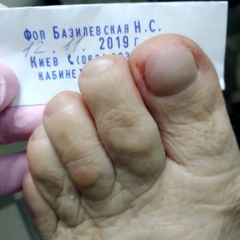 Фото с портфолио Центр подології Наталі Базилевскої