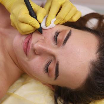 Коагуляция сосудов