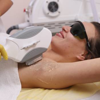 Элос-эпиляция