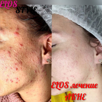 Фото с портфолио Elos Style