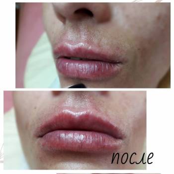 Фото с портфолио Валентина Колесниченко 