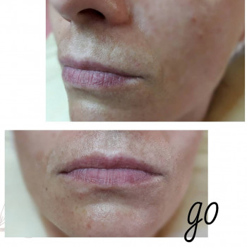 Фото с портфолио Валентина Колесниченко 