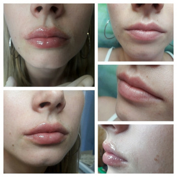 Фото с портфолио Валентина Колесниченко 