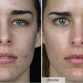 Фото с портфолио Татьяна Лисовская 