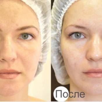 Фото с портфолио Татьяна Лисовская 