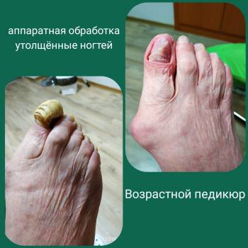 Педикюр для пожилых