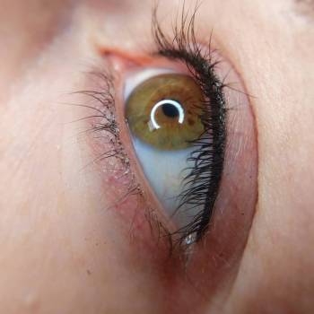 Межресничка