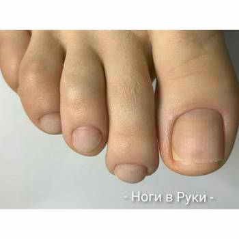 Ноги в Руки, Одеса Фото - 14