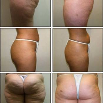 Фото с портфолио Валерия 