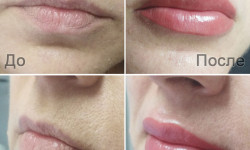 Татуаж губ / Перманентный макияж губ Майстер татуажу Татьяна Київ