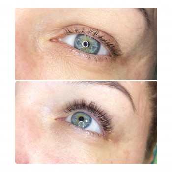 Ламинирование ресниц
                    Лешмейкер Марина  Одеса