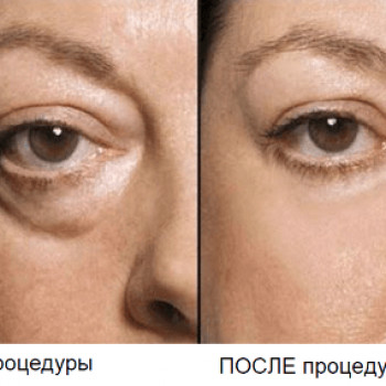 Фото с портфолио Анна 