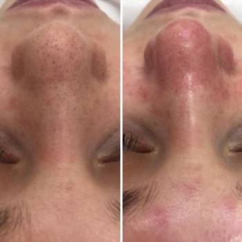 Фото с портфолио Вероника Кравченко 