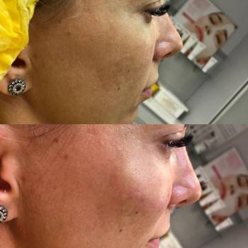 Фото с портфолио Вероника Кравченко 