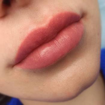 Зажившие губы после одной процедуры