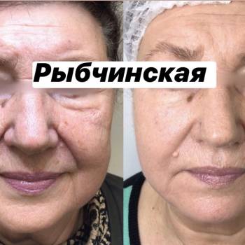 Наталія Рибчинська, Київ Фото - 62