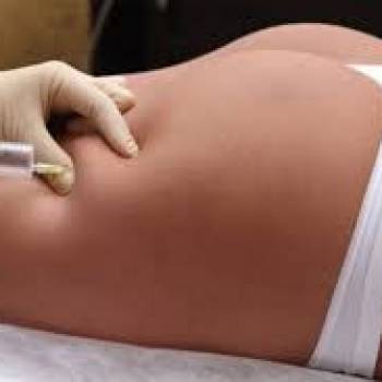 инъекции липолитиков 