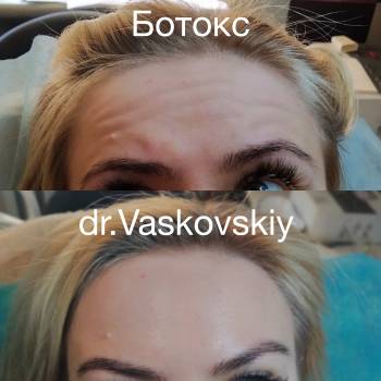 Вадим Васьковський, Житомир Фото - 12