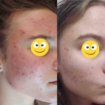 Вадим Васьковський, Житомир Фото - 17