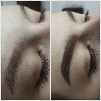 Корекція брів