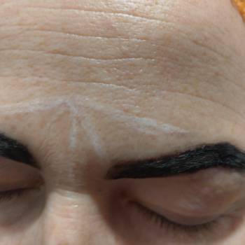 Реконструкция бровей - процедура улучшающая визуальные пропо