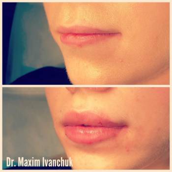 Максим Иванчук , Вишнёвое Фото - 5