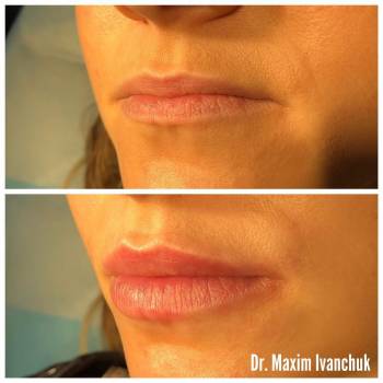 Максим Иванчук , Вишнёвое Фото - 6