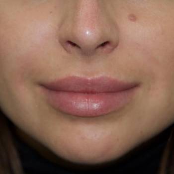 Максим Иванчук , Вишнёвое Фото - 7