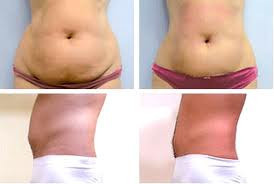 Фото с портфолио Стиль Лилий