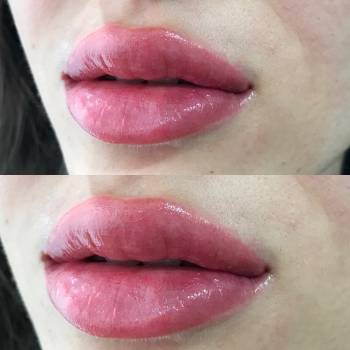 Анна Мурга , Харків Фото - 8