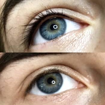 Межресничка 