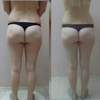 Людмила Жданкина , Одеса Фото - 5