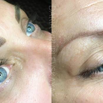 Исправление старого татуажа. До/после