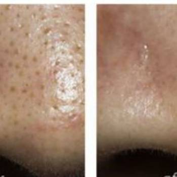 ArinaSKey, Київ Фото - 21