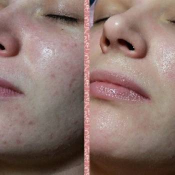 ArinaSKey, Київ Фото - 92