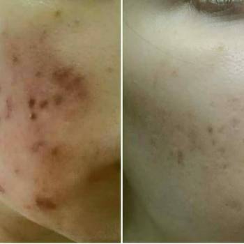 ArinaSKey, Київ Фото - 95