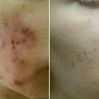 ArinaSKey, Київ Фото - 59