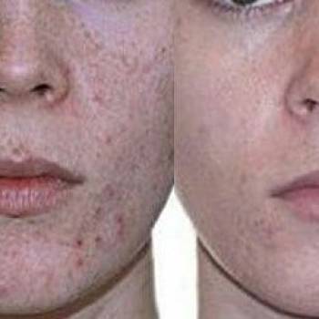 ArinaSKey, Київ Фото - 70