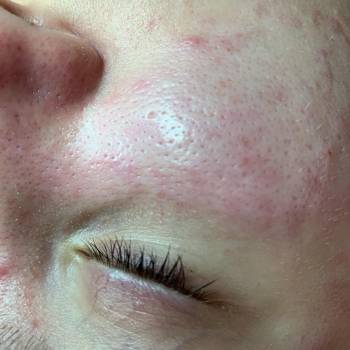 Валерия Бобух, Полтава Фото - 28